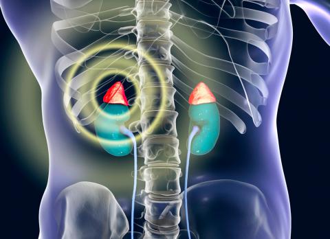 Insuficiencia suprarrenal aguda