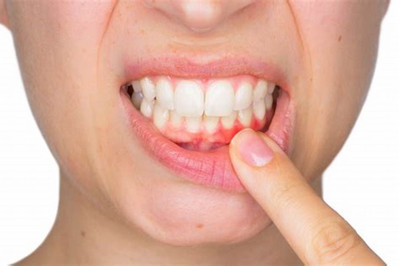 Las Enfermedades Periodontales Y La Pubertad