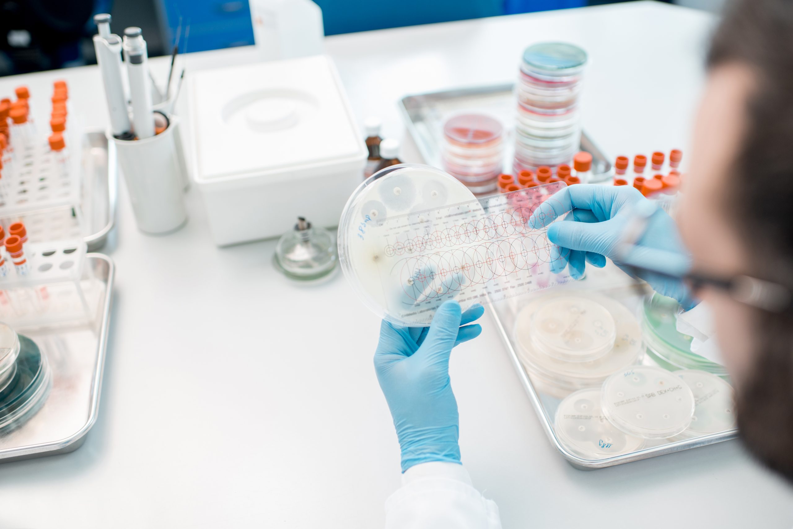 Cuáles son las diferencias y aplicaciones entre el lector de microplacas y limpiadores de microplacas?