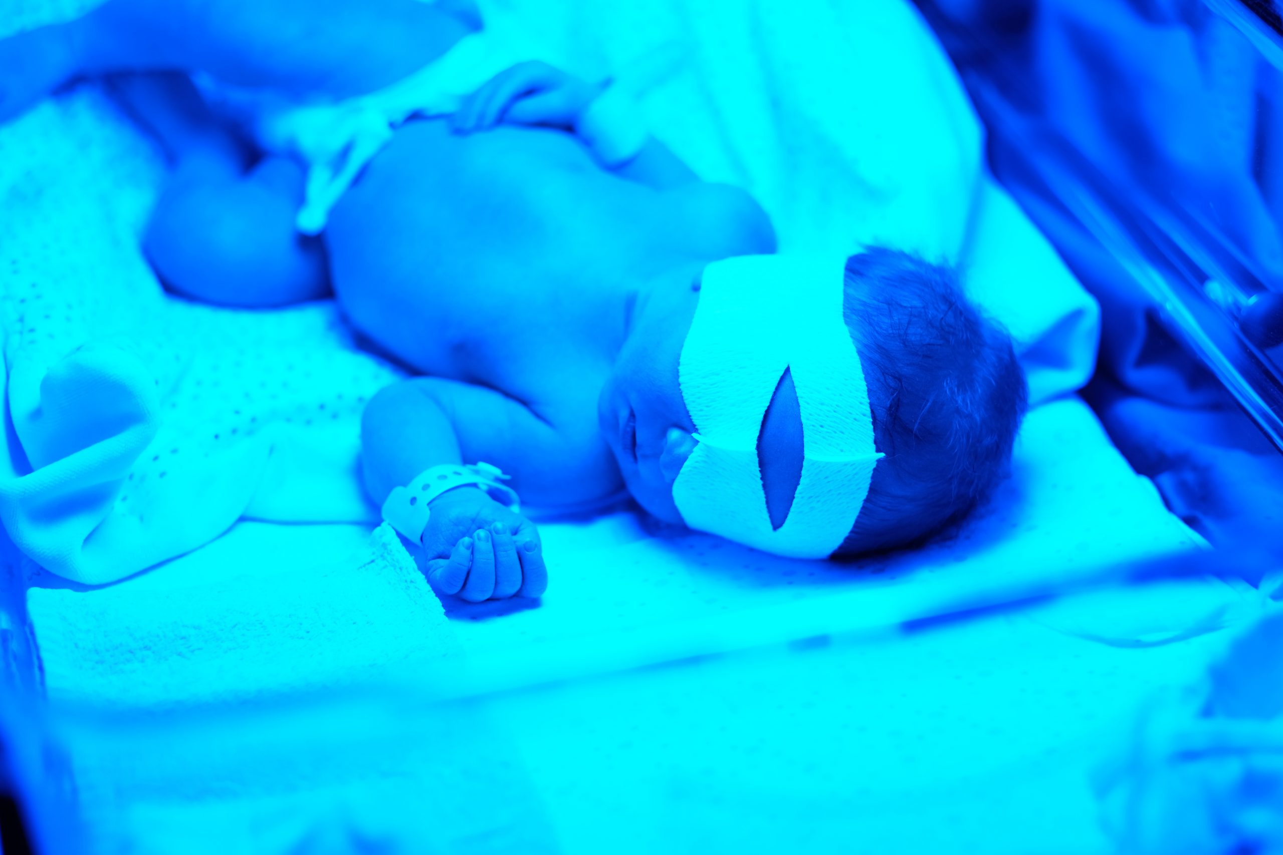 ¿Cuáles son los tipos de luz para la fototerapia infantil?